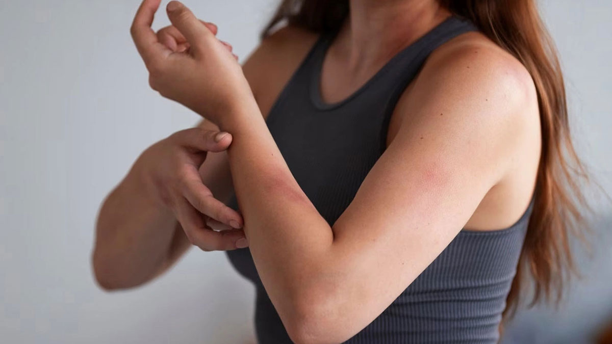 En ufak bir çarpmada bile cildiniz morarıyorsa bu değerlerinize acilen baktırmalısınız! Sakın hafife almayın