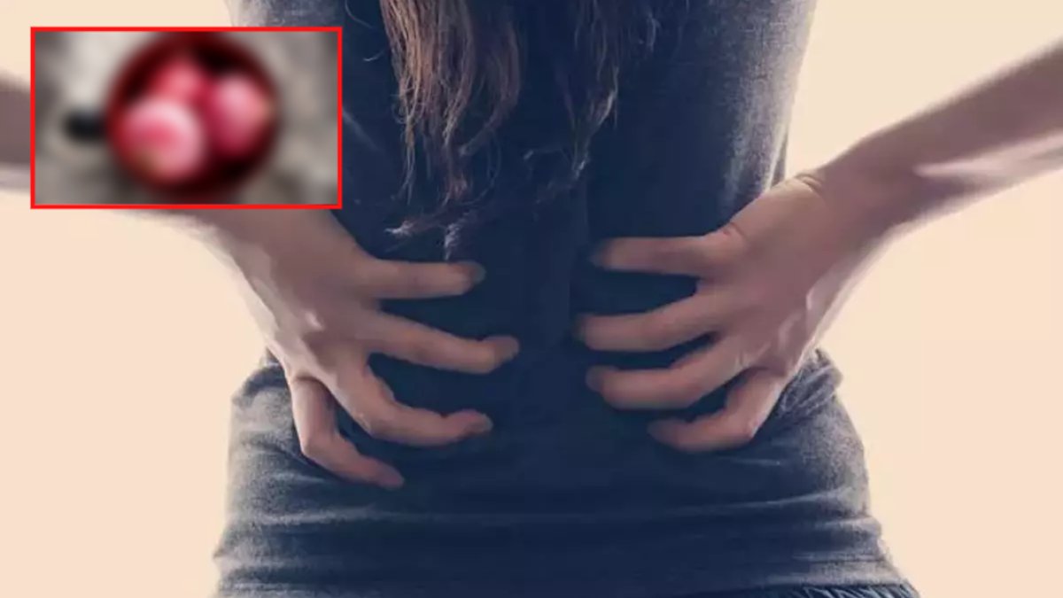 Böbrek ve safra kesesi taşlarını düşürmekle bire bir! Taşları doğal yöntemlerle, acısız bir şekilde atabilirsiniz