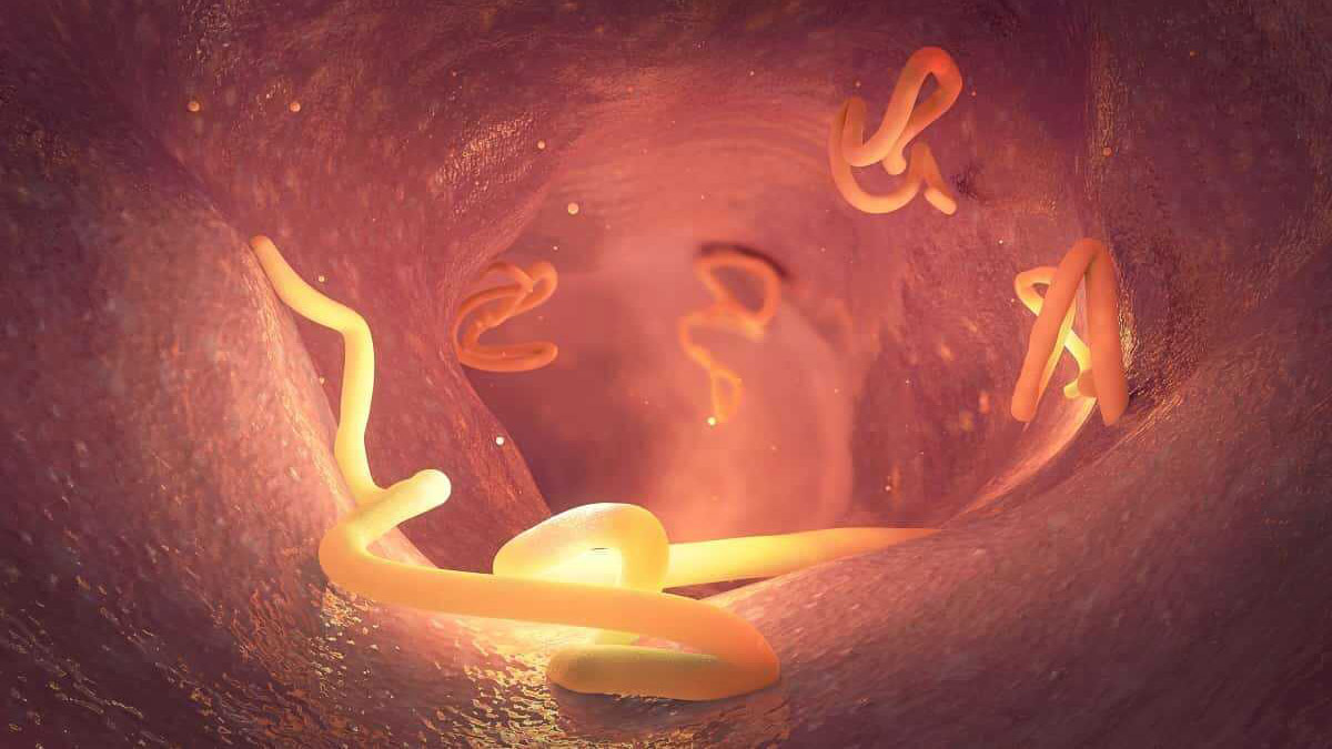 Bağırsak kıl kurdu neden olur?