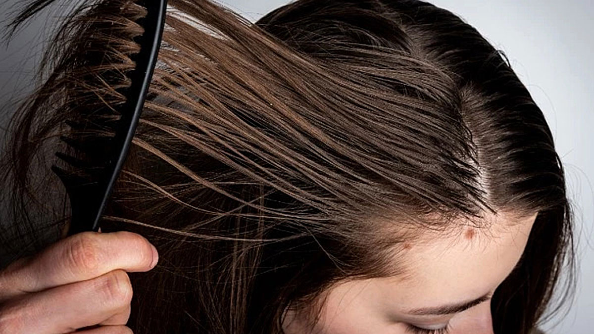 Yağlı saçlardan kurtulmak meğer bu kadar kolaymış! Yağlı saçlarla mücadele için 5 yöntem