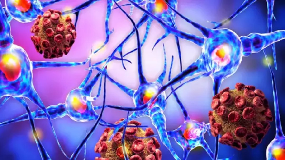 Lezyon Nedir: Anlamı ve Tedavi Yöntemleri