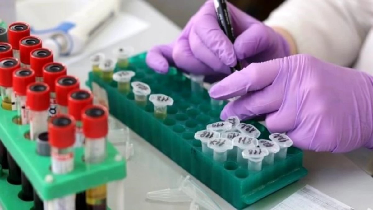 Lym Yüksekliği Nedir: İmmün Sistemimizin Sessiz Muhafızları