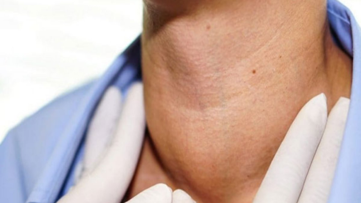 Lenfoma Nedir? İşte Belirtileri, Teşhisi ve Tedavi Seçenekleri