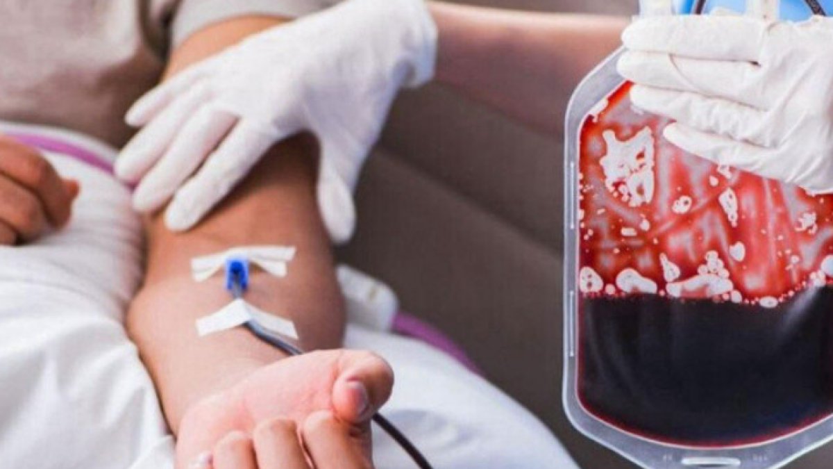 Hematoloji Nedir: Kanın Gizemli Dünyası