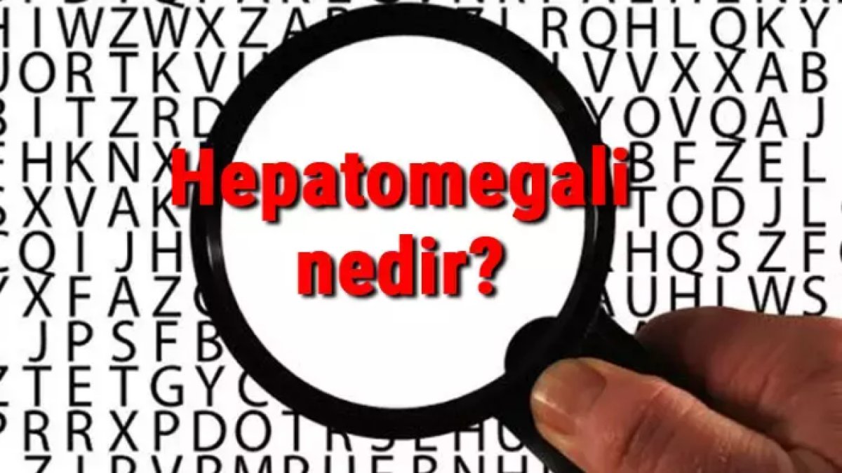 Hepatomegali Nedir? Karaciğer Büyümesi Hakkında Bilmeniz Gerekenler