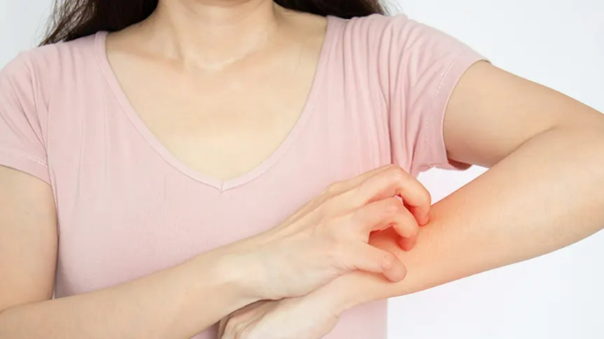 Gece Kaşıntı Sebepleri: Rahatsızlığın Ardındaki Gizli Nedenler