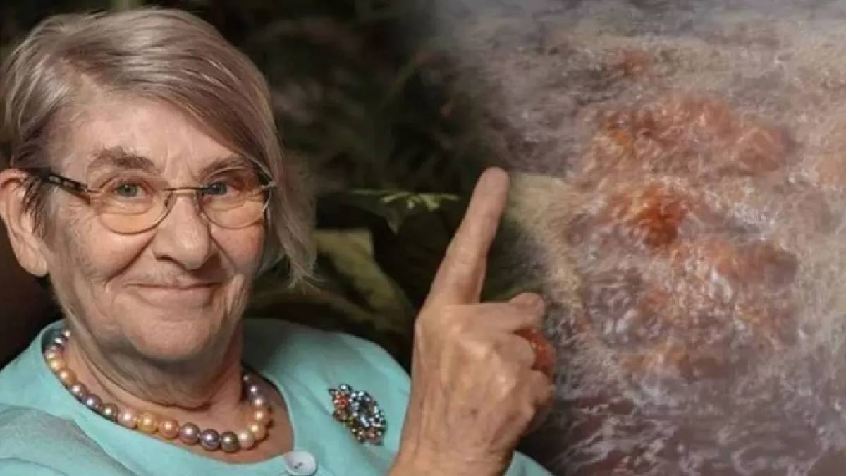 Canan Karatay pekmezle beraber tüketin diyerek tavsiye etti! Tıkalı damarı açıyor, yaşlanmayı önlüyor