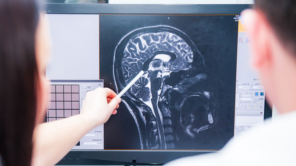 İlk kez ortaya çıktı: Beyin bile hüzünlü anları hatırlamak istemiyor! Bilim insanlarından çarpıcı 'beyin' araştırması