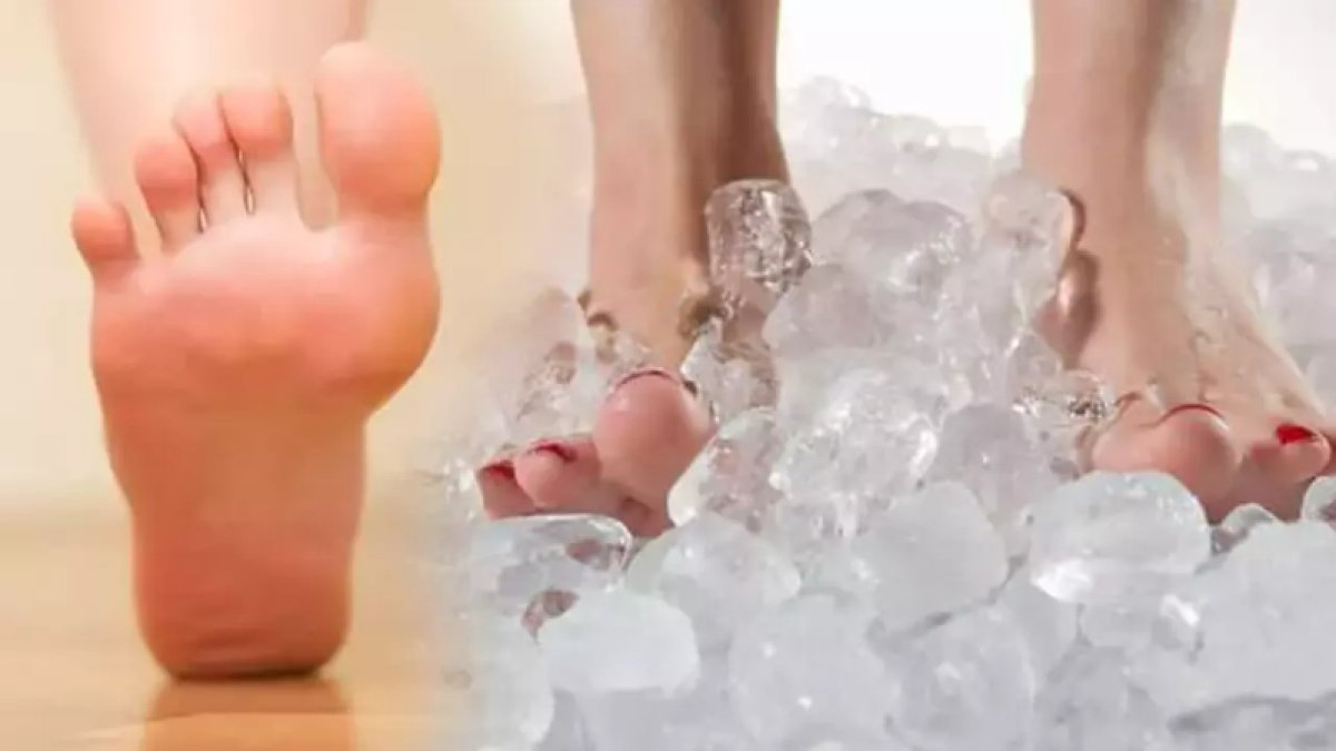 Ayak Altı Neden Yanar?