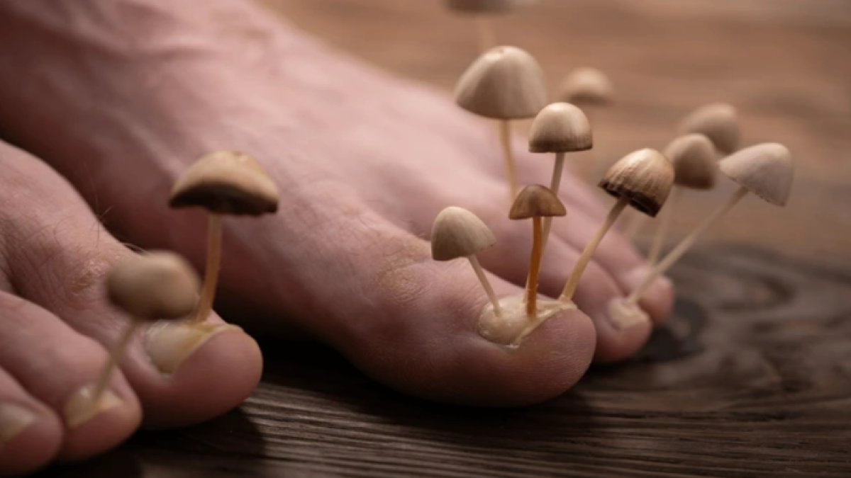 Ayak Mantarı Nasıl Geçer: Etkili Çözümler ve İpuçları