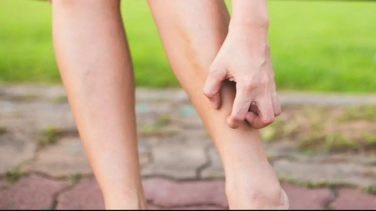 Bacaklarda Kaşıntı Neden Olur: Rahatsız Edici Bir Sorunun Altında Yatan Sebepler