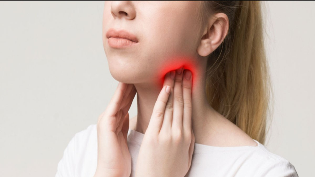 Bademcik İltihabına Ne İyi Gelir: Doğal Çözümler ve Tedavi Yöntemleri