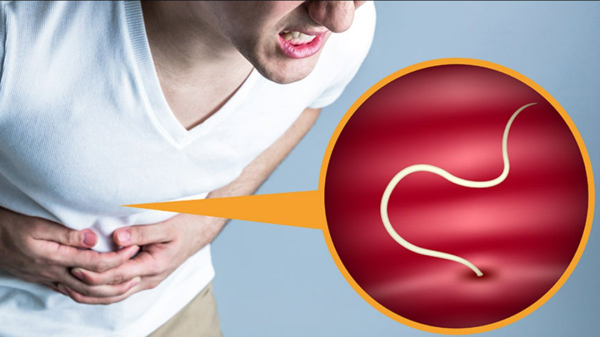 Bağırsak Kurdu Nasıl Düşürülür: Sağlıklı Bir Yaşam İçin İpuçları