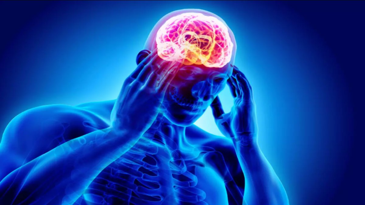 Başın Sağ Tarafında Ağrı: Nedenleri, Tedavileri ve Öneriler