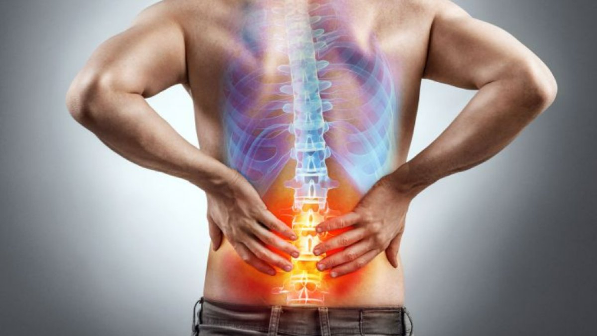 Bel Fıtığı Belirtileri: Sırt Ağrısının Altında Yatan Tehlike
