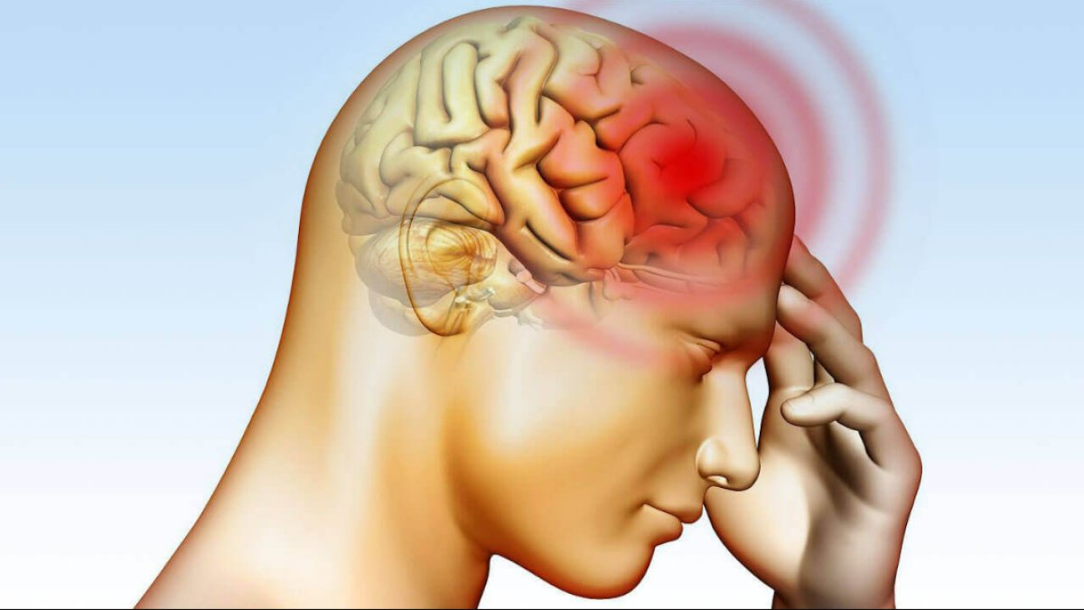 Beyin Kanaması Belirtileri: Tehlikeli Bir Durumu Tanımak