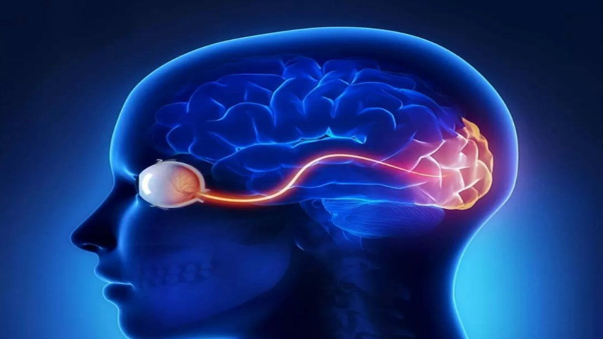 Beyin Tümörü Neden Olur: Beyin Sağlığı Üzerine Bir İnceleme