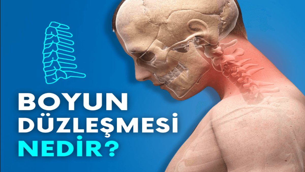 Boyun Düzleşmesi Neden Olur: Baş ve Boyun Ağrılarının Gizli Sebepleri
