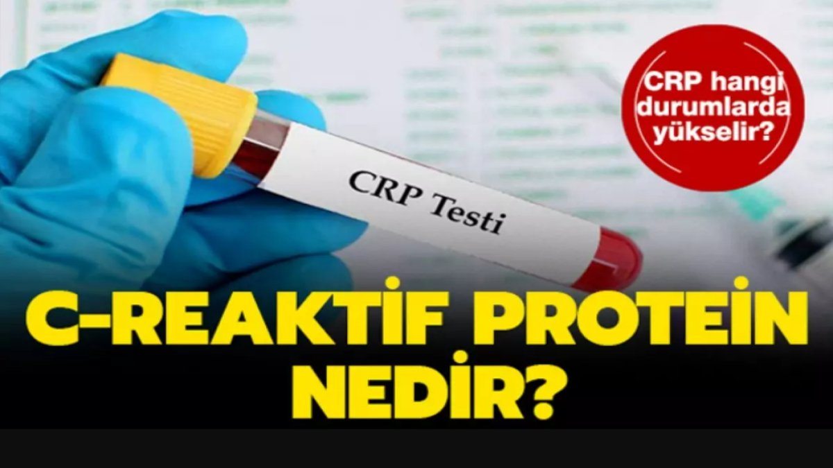 C-Reaktif Protein Nedir? Hızlı bir şekilde C-Reaktif Protein (CRP) hakkında bilgi edinin!