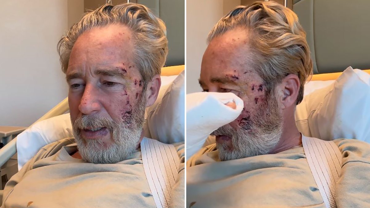 Oyuncu Sinan Albayrak sette kaza geçirdi: İsrail'in parmağı yok, merak etmeyin