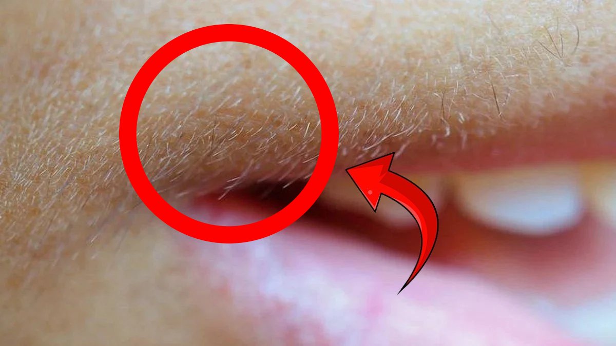 Şekerle limonu karıştırıp yüzünüze sürün, sonsuza kadar kurtulun..