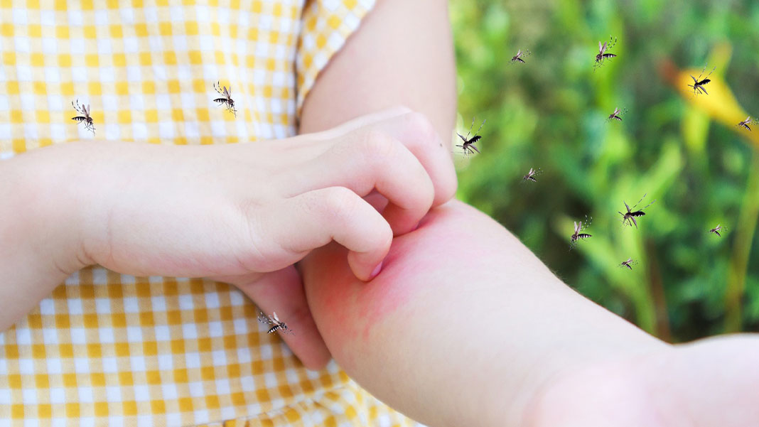 Güney Amerika'da dang humması artışı