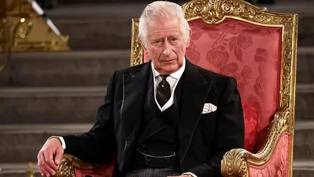 Kral Charles prostat tedavisi için hastaneye kaldırıldı