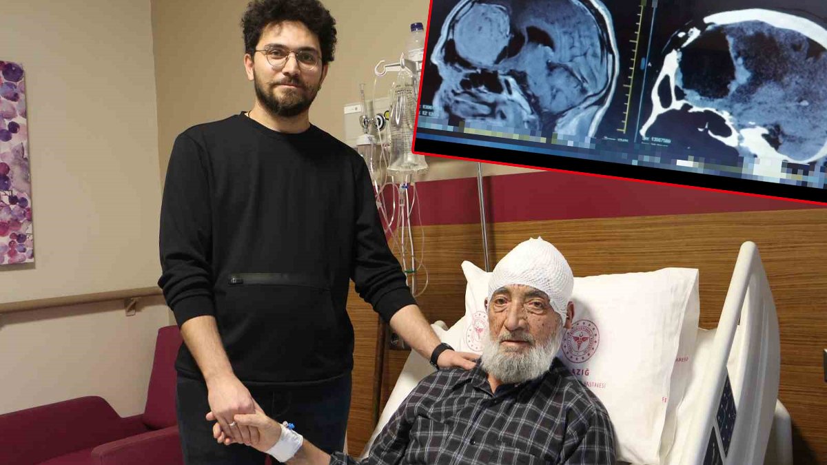 Baş ağrısı şikayetiyle doktora gitti, hayatının şokunu yaşadı: Acil ameliyata alındı