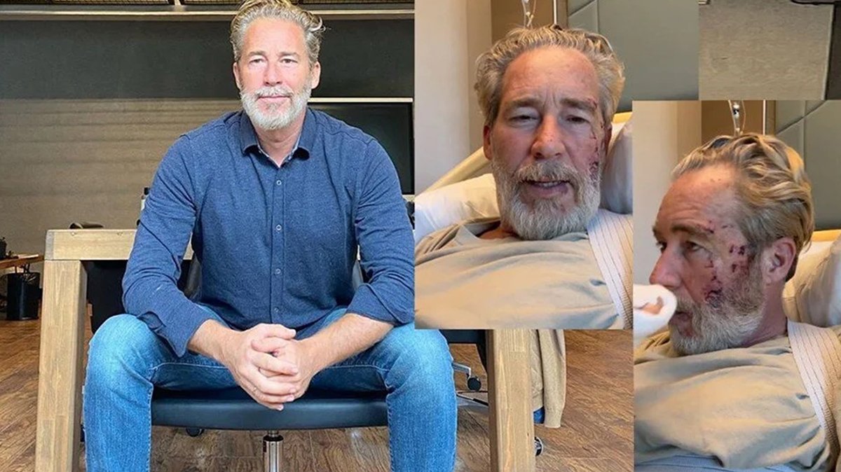 Mehmed: Fetihler Sultanı dizisinde feci kaza! Omurgası, çenesi, eli kırıldı