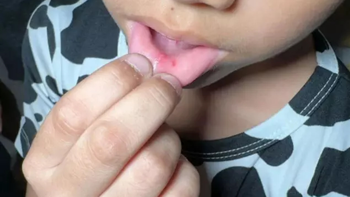 'Öğretmen'den öğrencilere akılalmaz 'sakız' cezası: Dudaklarını çengelli iğneyle deldi!