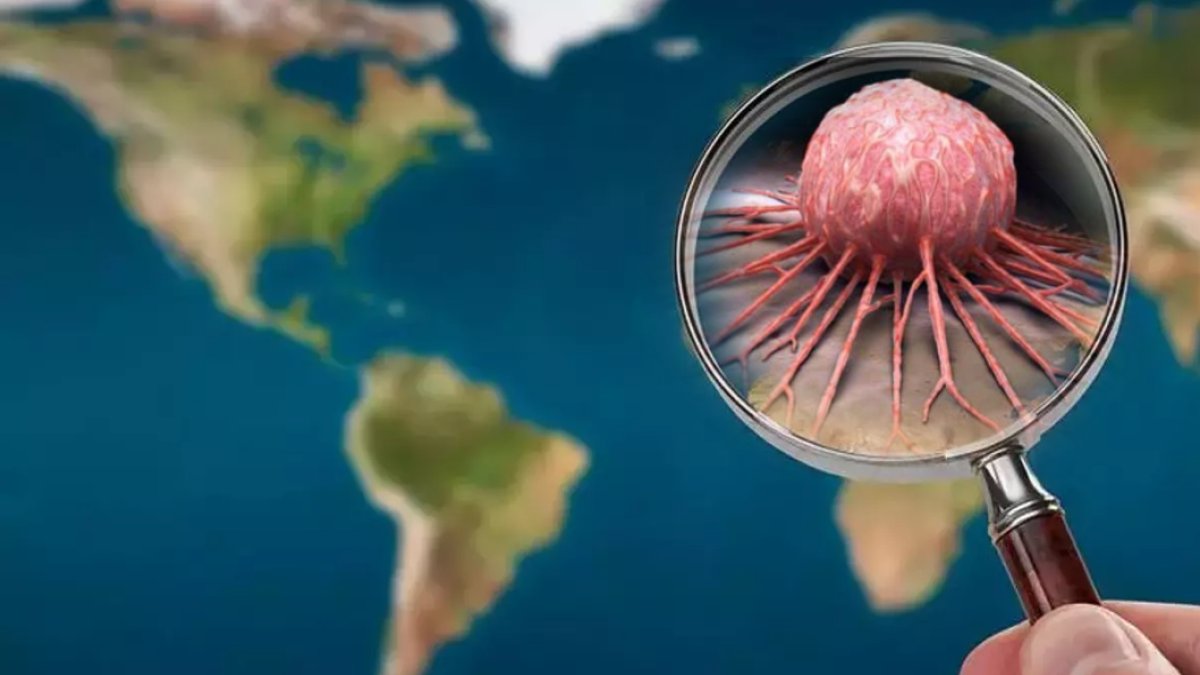Dünyada en çok görülen kanser türü! Kolay kolay anlaşılmıyor: Erken yaşta ölümcül olabiliyor