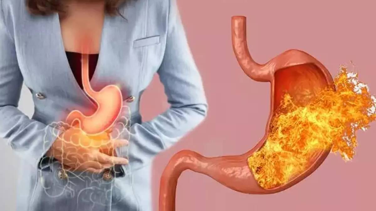 Mide yanmaları, bulantılar, hazımsızlıklar… Yıllardır süren reflü şikayetiniz 30 dakikada bitecek: Uzman isimden mucize yöntem - KARAR