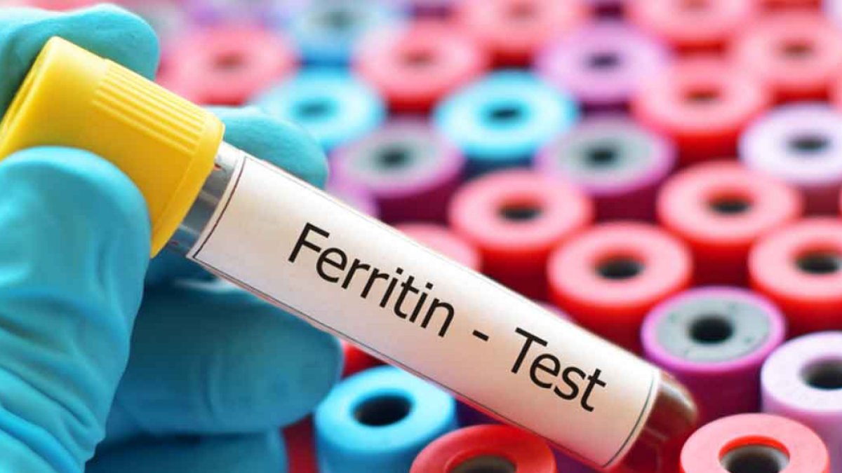 Ferritin Düşüklüğü Belirtileri ve Tedavisi