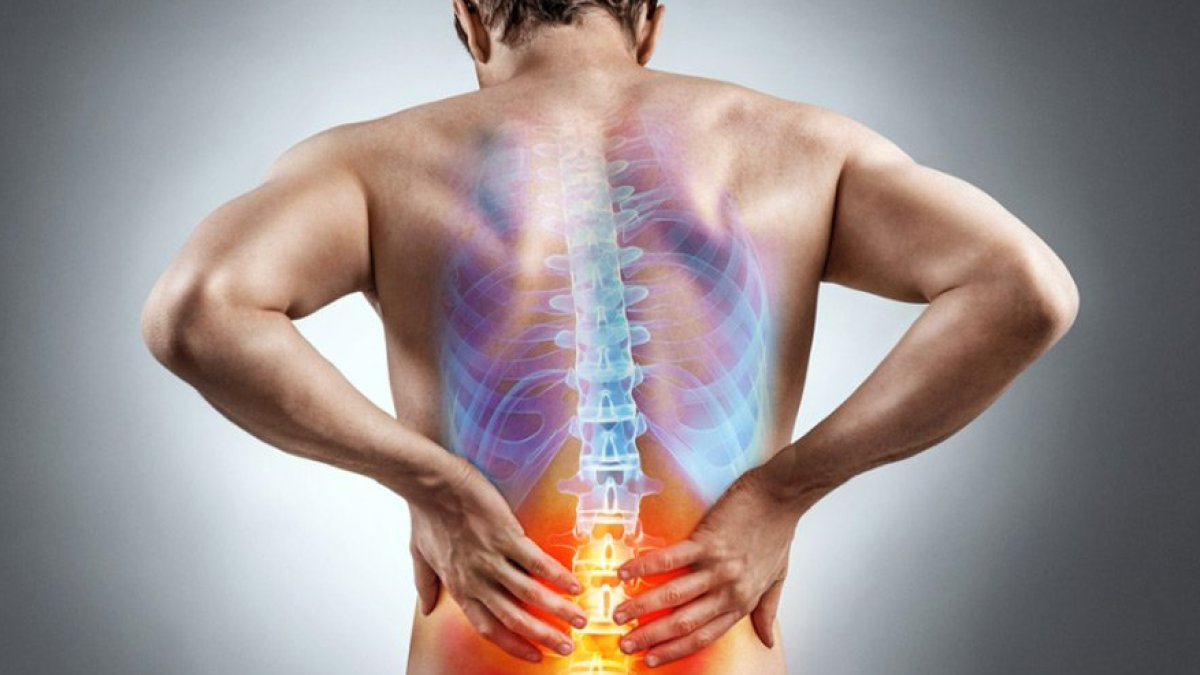 Fıtık Ağrısı Nereye Vurur?