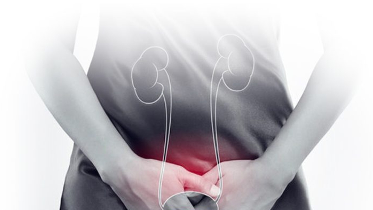 Ağrılı mesane sendromu nedir? Tanı ve tedavi yöntemleri