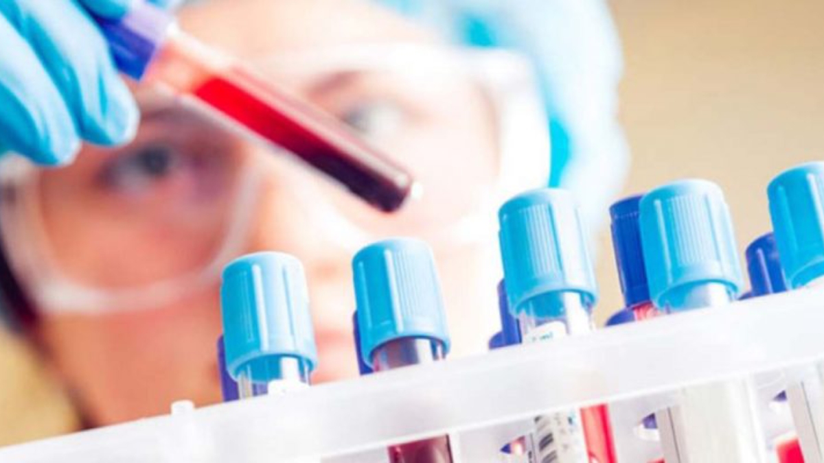 Tiroglobulin (Anti TG) nedir?