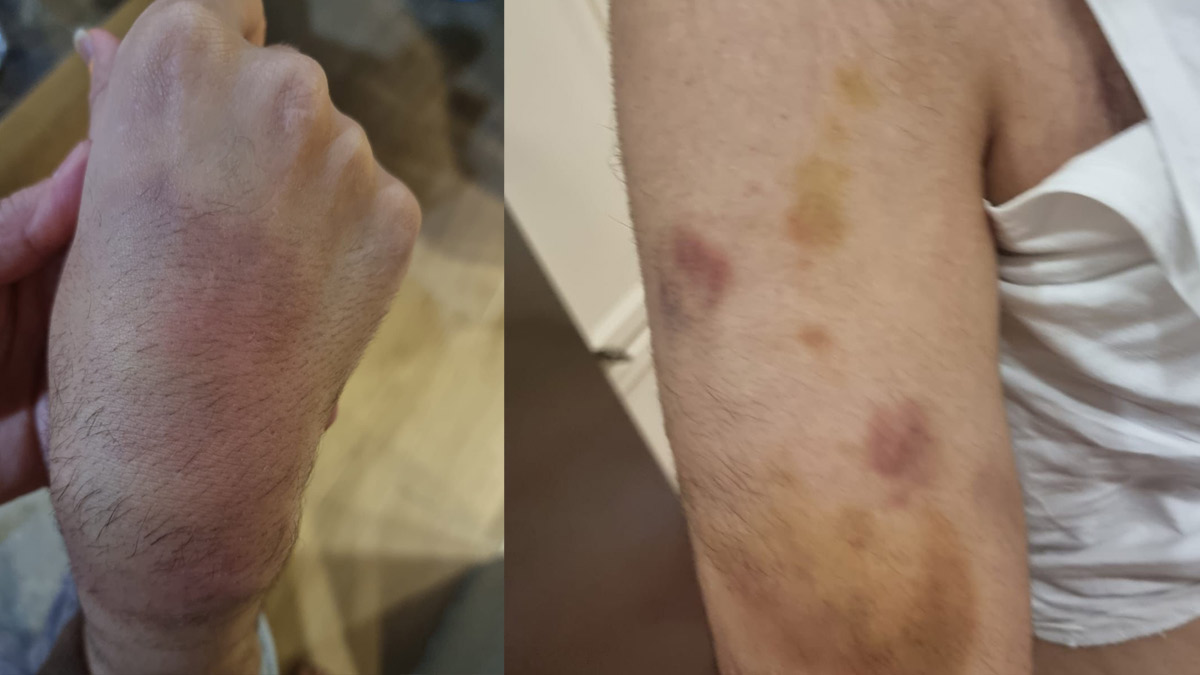 Büyükçekmece'de spor okulunda dehşet! Otizmli öğrenciyi darp eden öğretmen tutuklandı