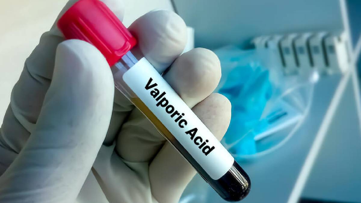 Valproik asit testi nedir?