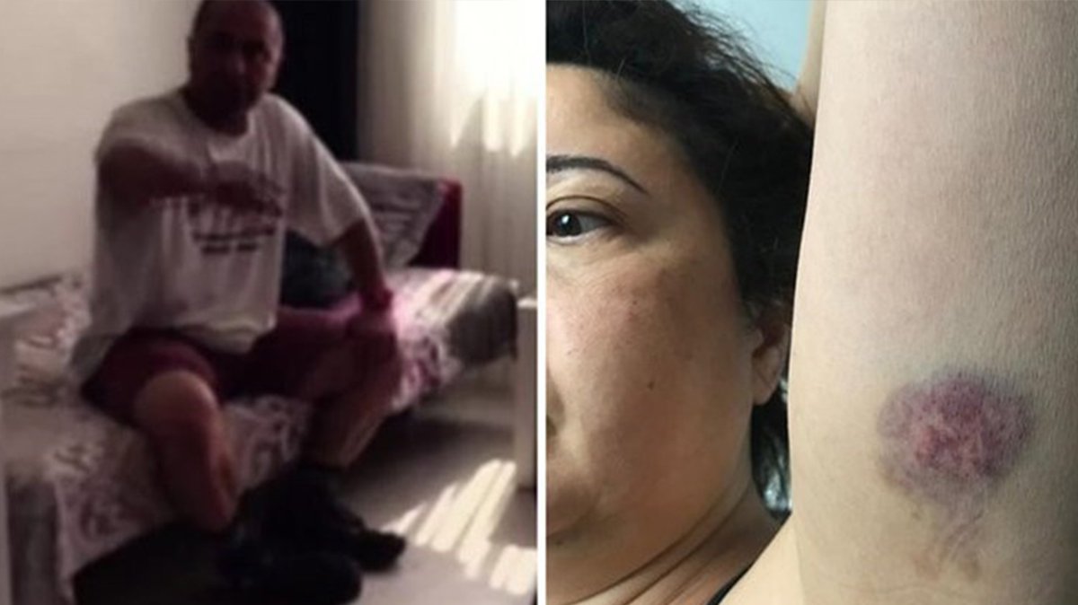 Kiracısını darbetmişti! Ev sahibine 7 yıl hapis