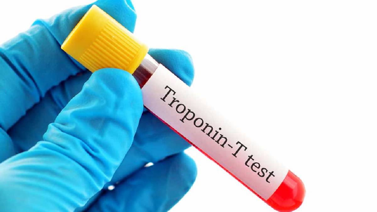 Troponin testi nedir?