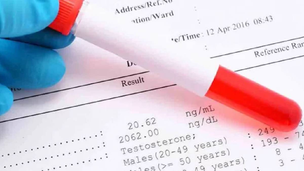 Total IgE Testi nedir?