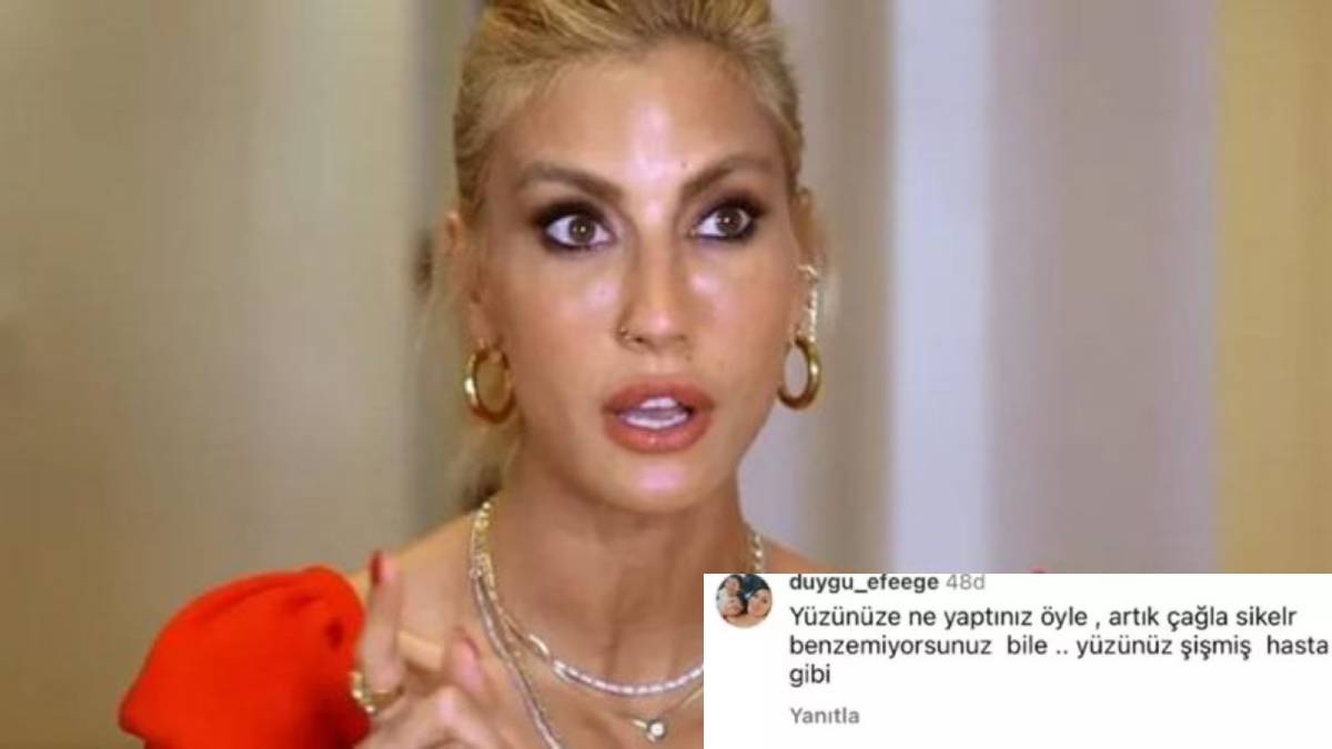 Çağla Şikel takipçisine hiç acımadı! Yüzüne ne yaptın diyen hayranına sosyal medyadan cevabı olay oldu