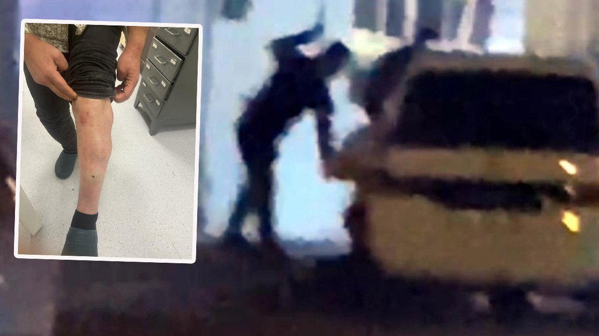 'Vurma' diyerek yalvardı: Coplarla darbettiler