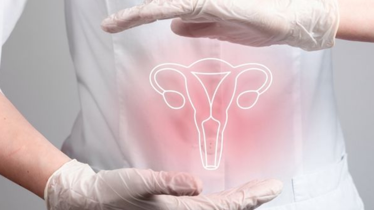 Çikolata kisti nedir? Belirtileri belerdir? Tedavisi nasıl olur?