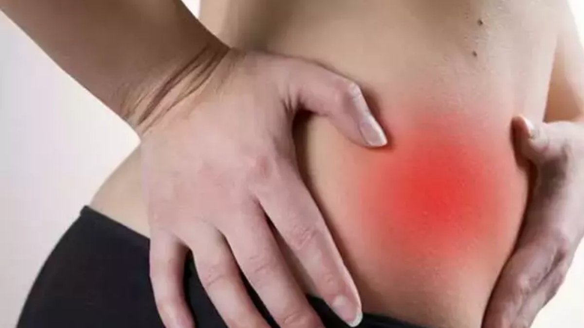 Göbek Düşmesi Nedir: Sağlık ve Estetik Bir Sorun