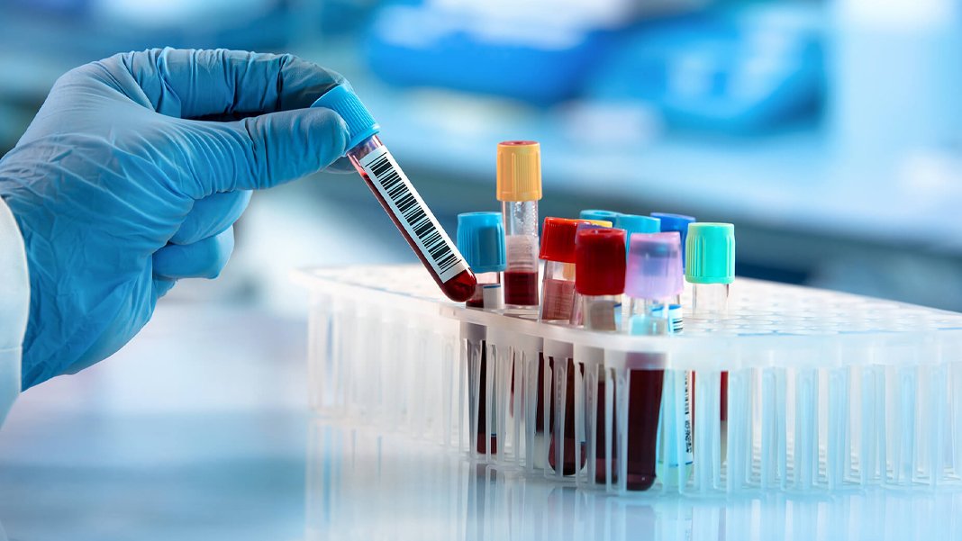 Bilim insanlarından çığır açan adım: Demansı 15 yıl önceden haber verecek