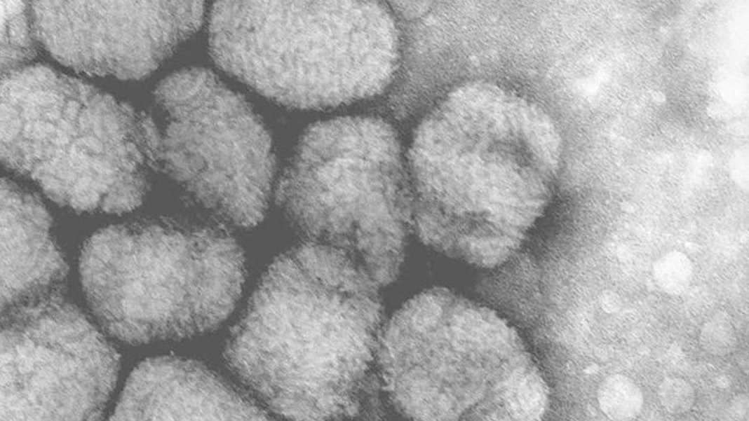 Alaska Çiçeği virüsünde ilk ölüm