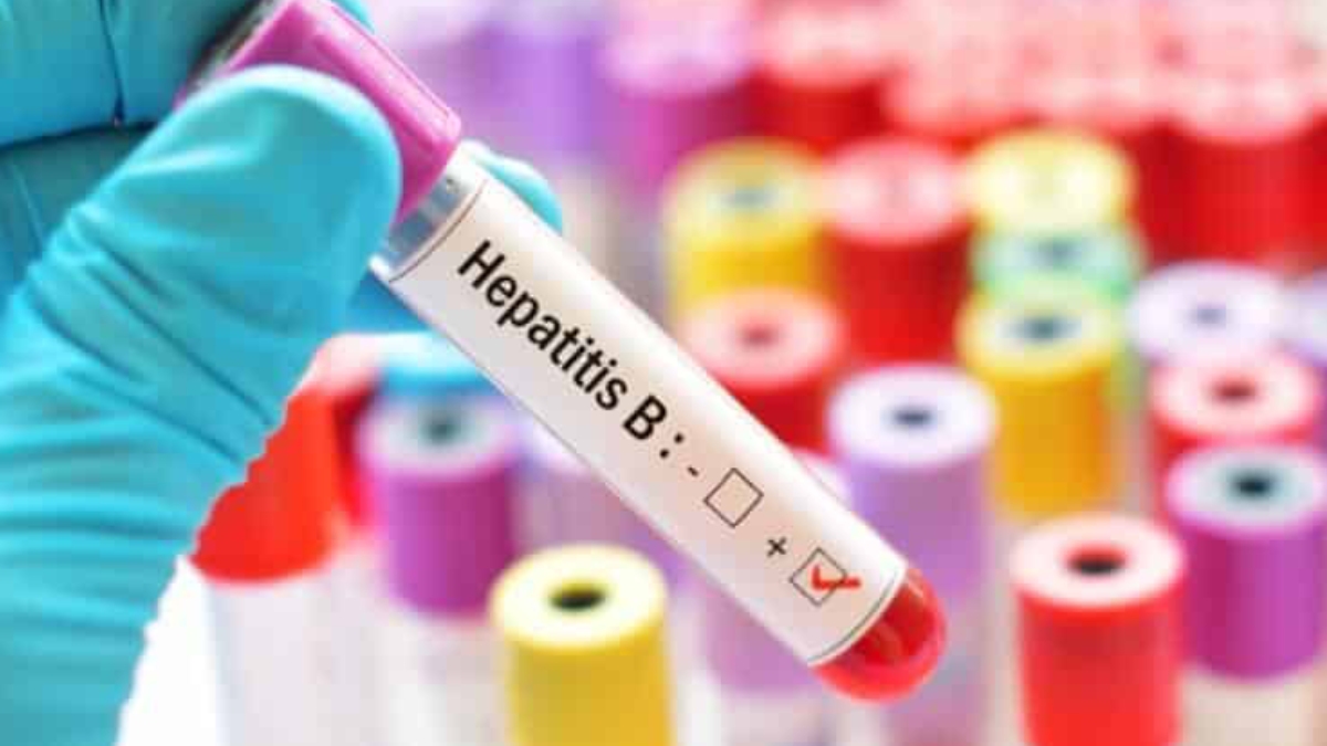 Hepatit B testi nedir?