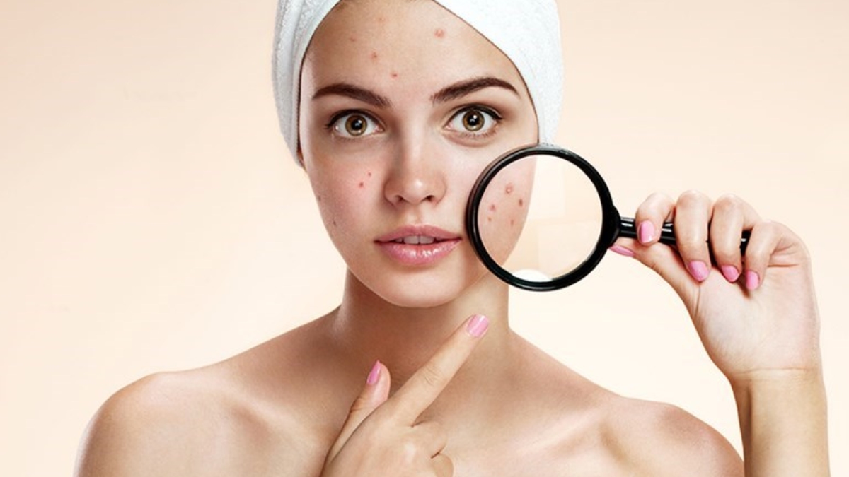 Histamin İntoleransı nedir?