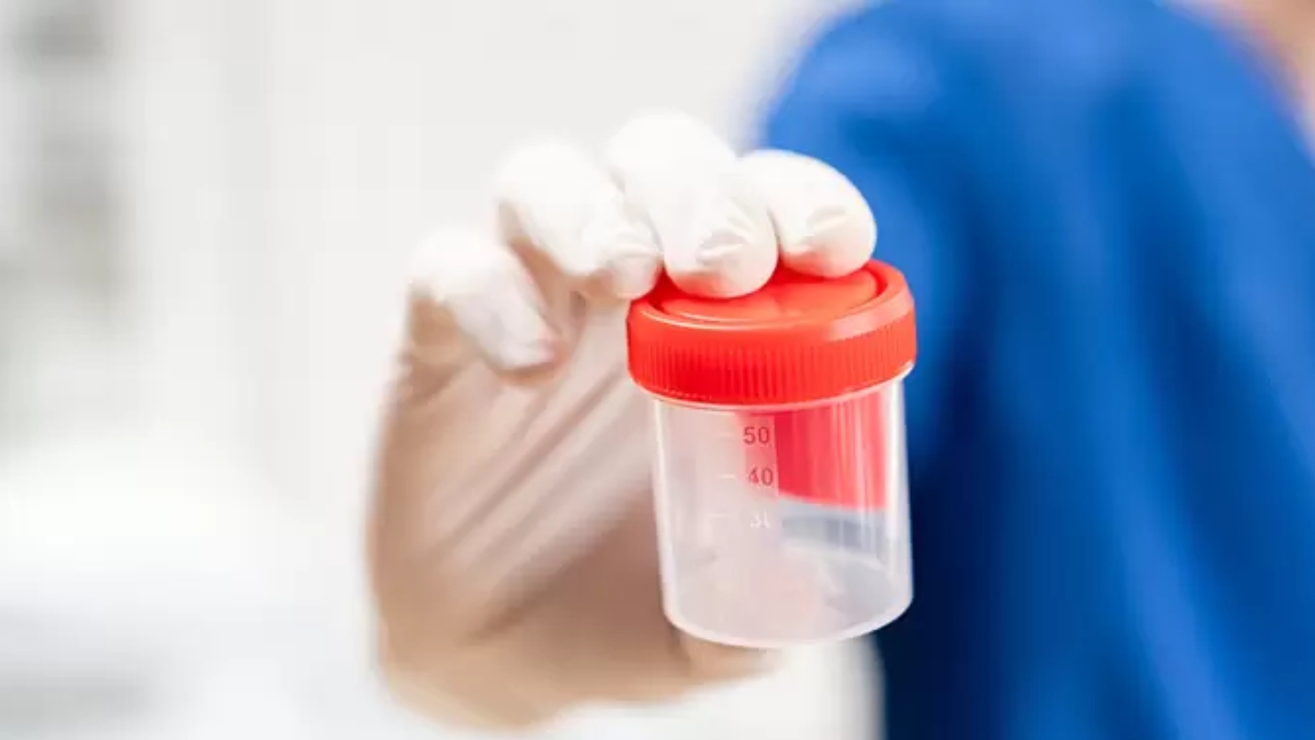 İdrar kültürü testi nedir?